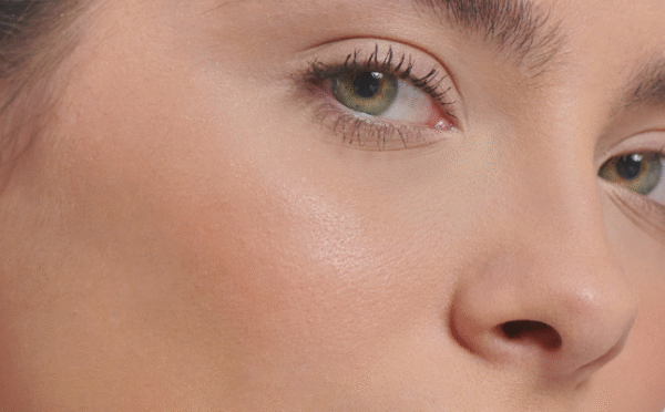 Vamos falar sobre poros?